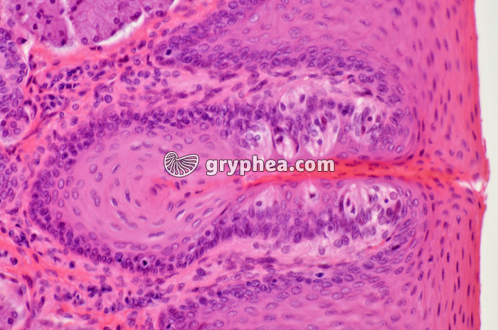 Langue x100 - gryphea.org